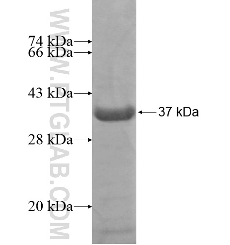 FAM21C fusion protein Ag15066 SDS-PAGE FAM21C fusion protein Ag15066 SDS-PAGE