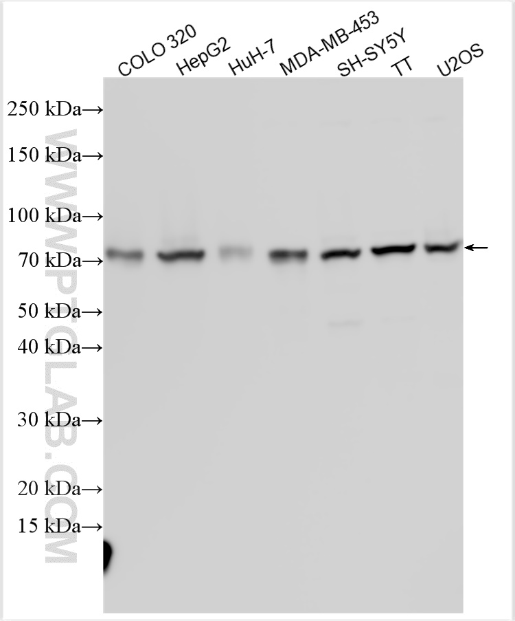 WB analysis using 31914-1-AP