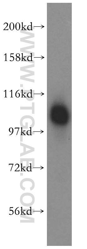 WB analysis of Jurkat using 16933-1-AP