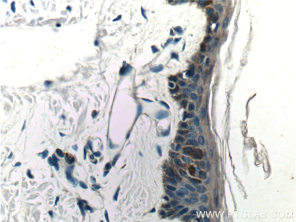 IHC staining of human skin using 15939-1-AP