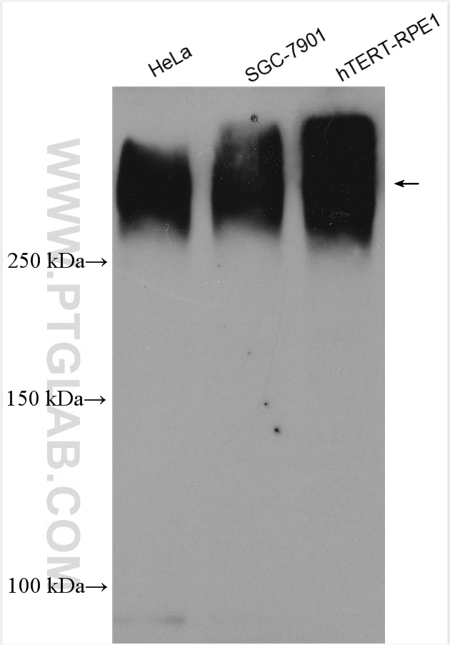 WB analysis using 15939-1-AP