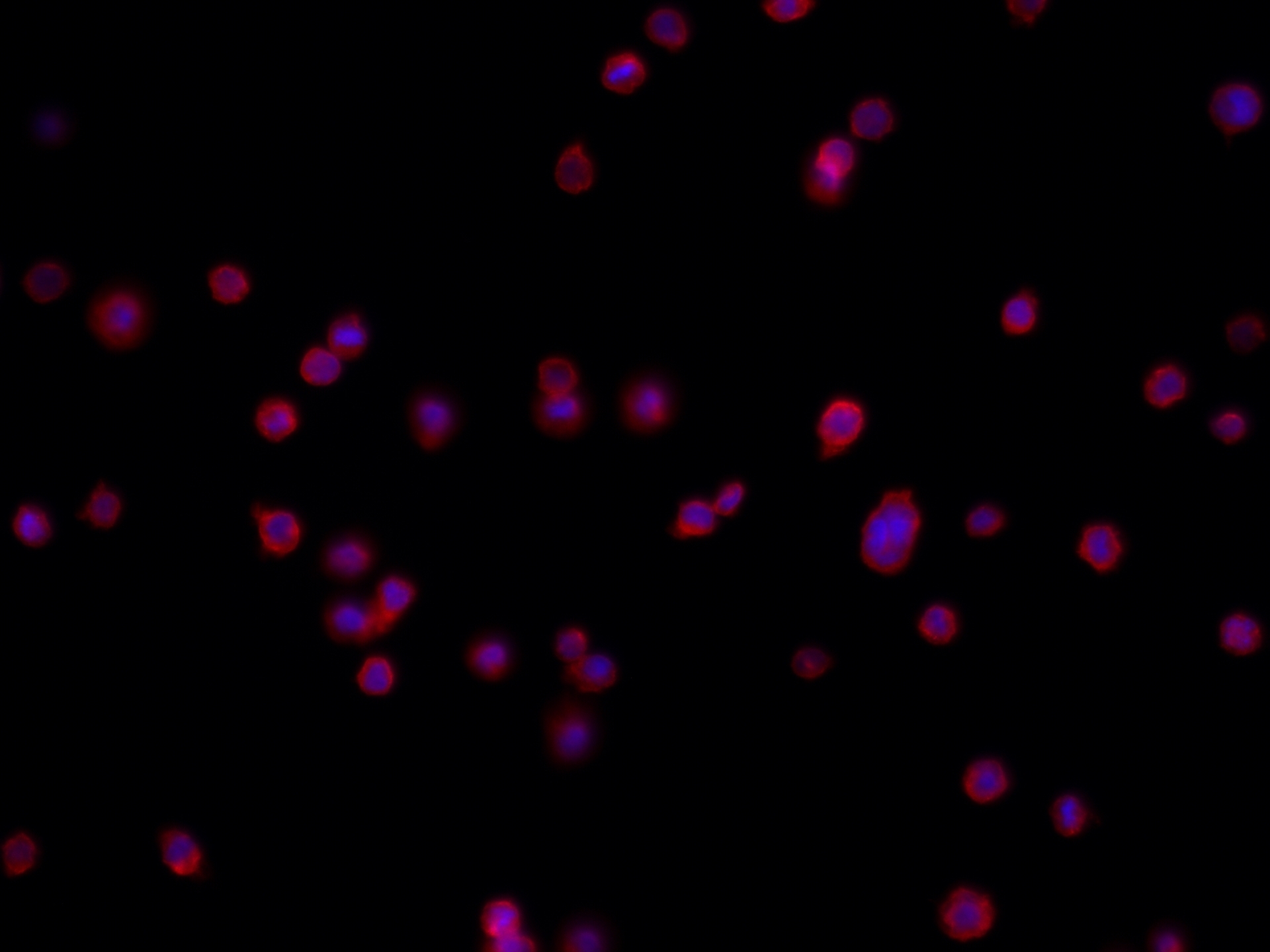 Piezo1 (extracellular domain)