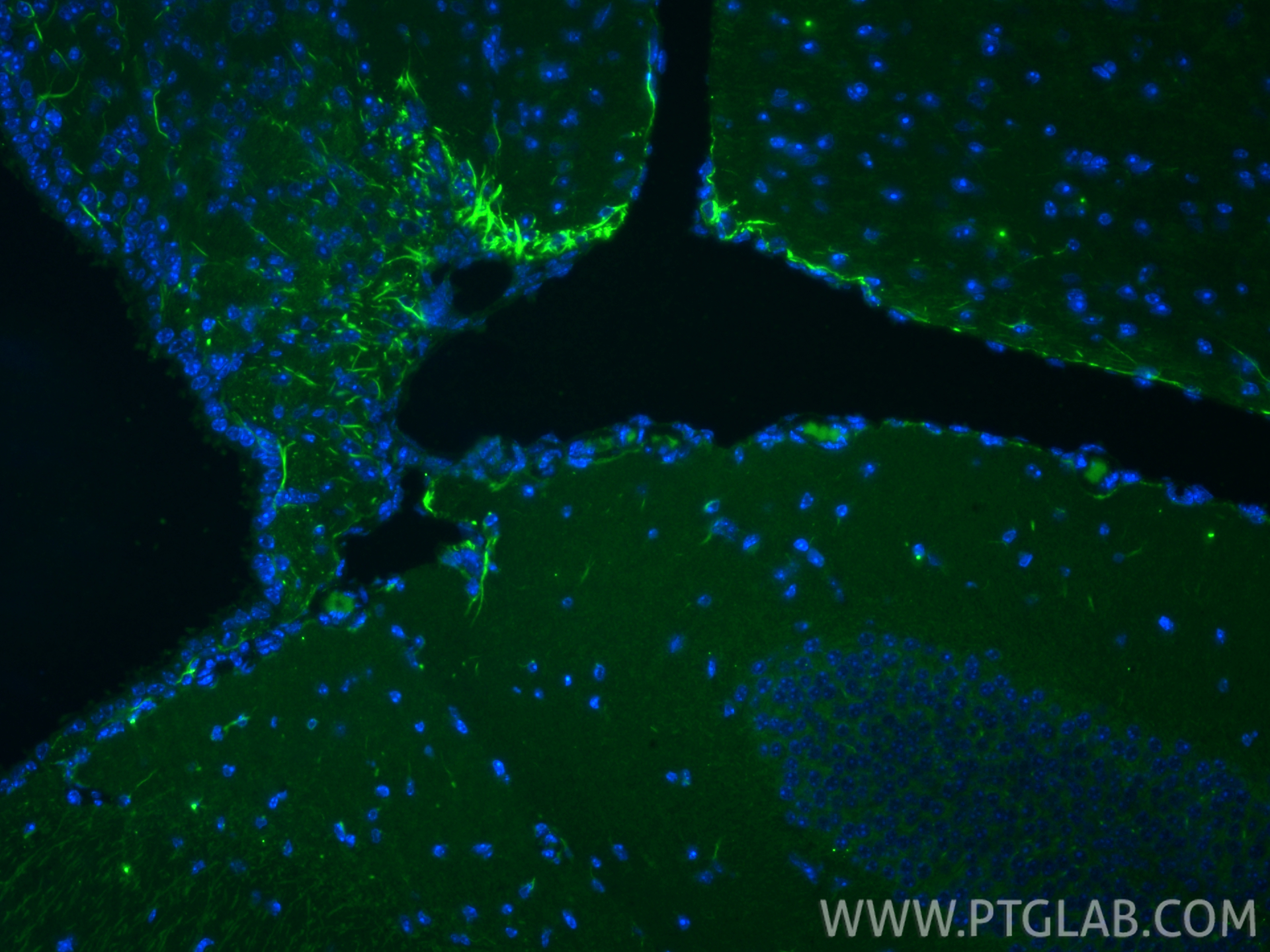 IF Staining of mouse brain using 82625-4-RR (same clone as 82625-4-PBS)