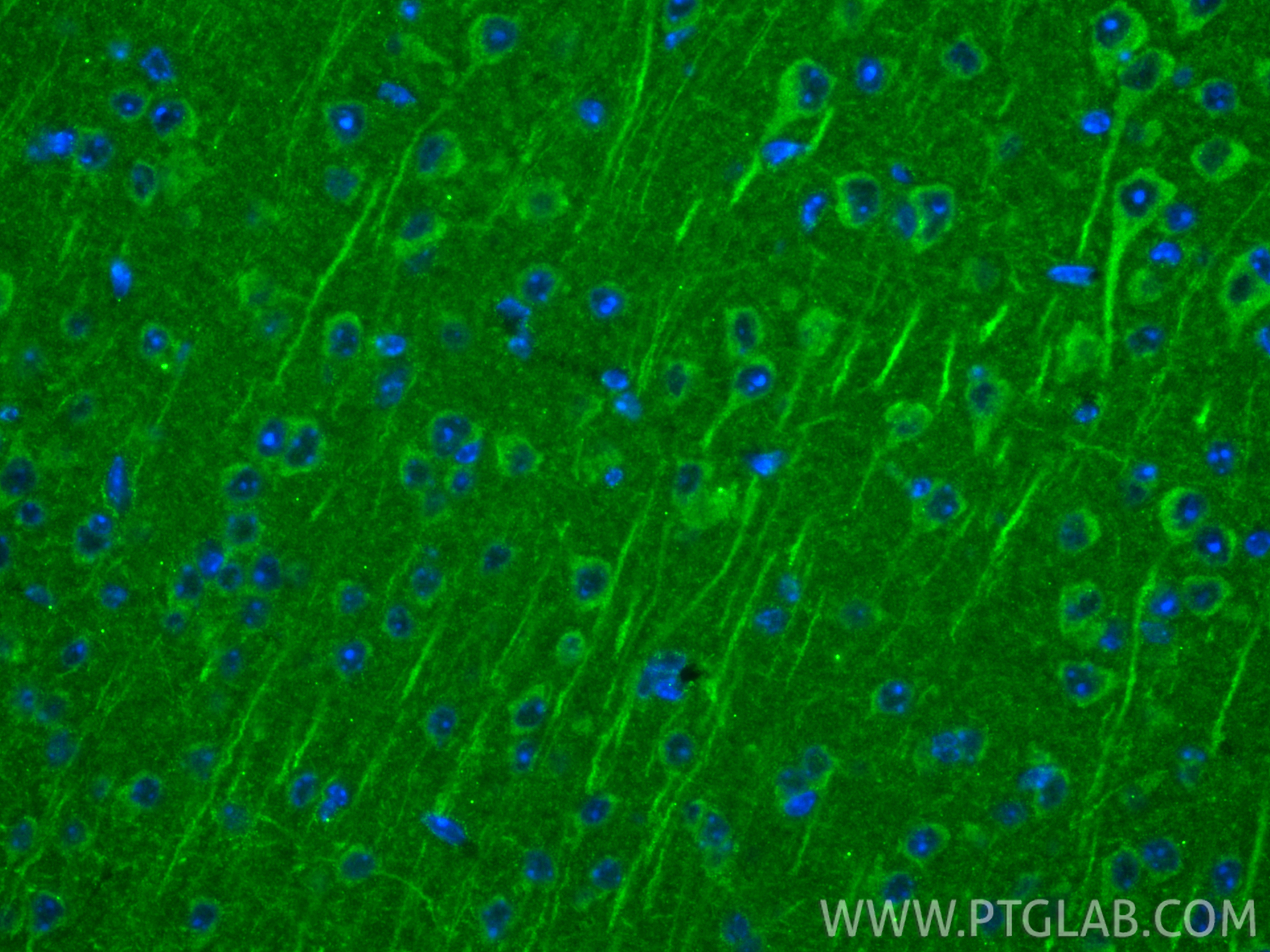 IF Staining of mouse brain using 82625-4-RR (same clone as 82625-4-PBS)