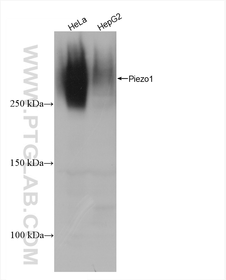 WB analysis using 82625-4-RR (same clone as 82625-4-PBS)