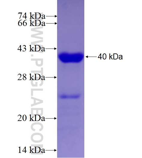 FAM38A fusion protein Ag7887 SDS-PAGE