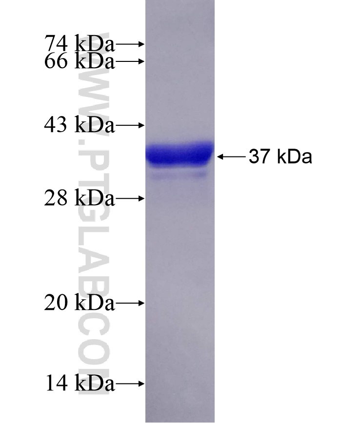 FAM38B fusion protein Ag24528 SDS-PAGE