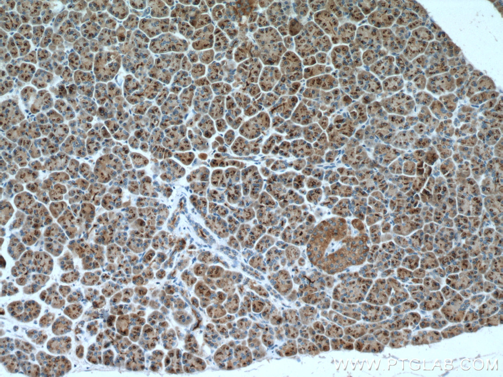 IHC staining of human pancreas using 27131-1-AP