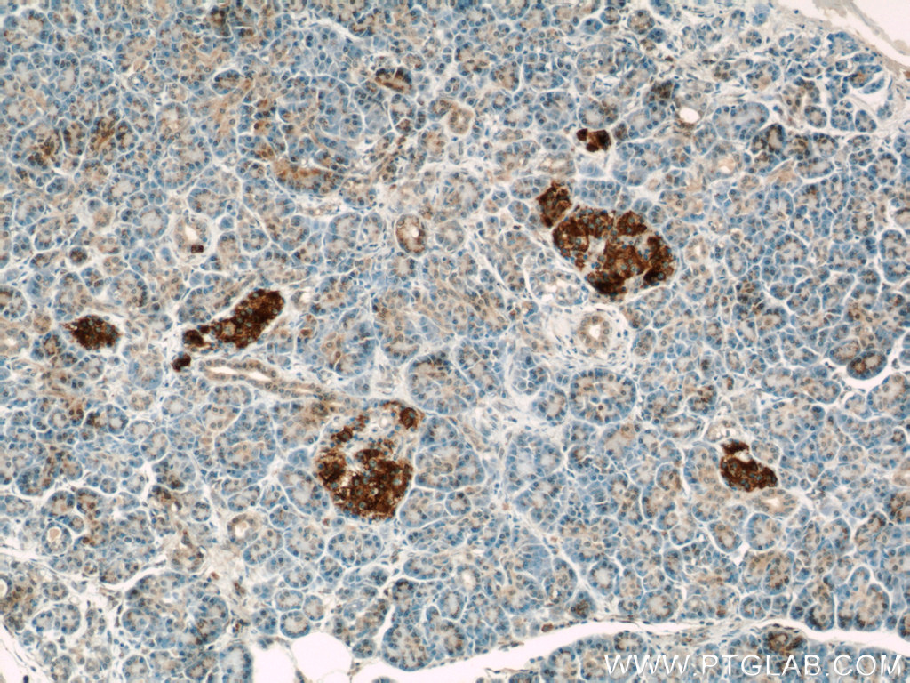 IHC staining of human pancreas using 14247-1-AP