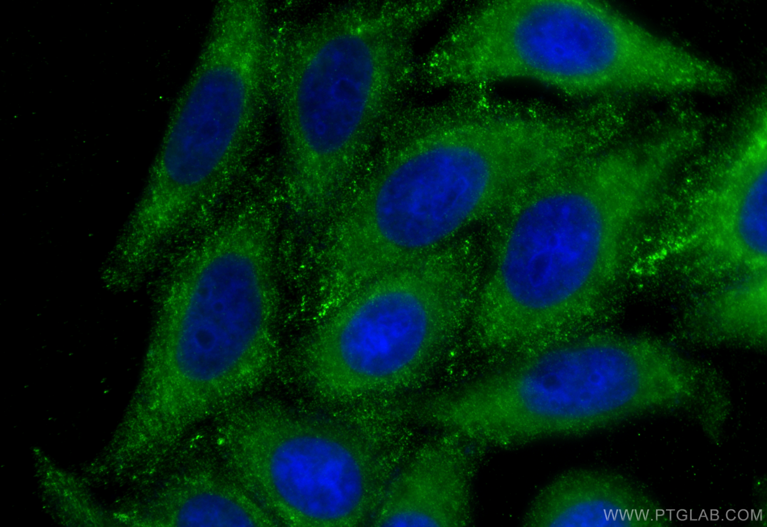 IF Staining of HepG2 using 60282-1-Ig