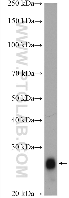 WB analysis of mouse colon using 12336-1-AP