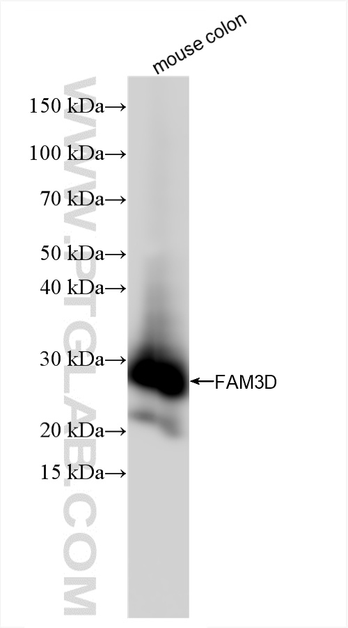 WB analysis of mouse colon using 86090-1-RR