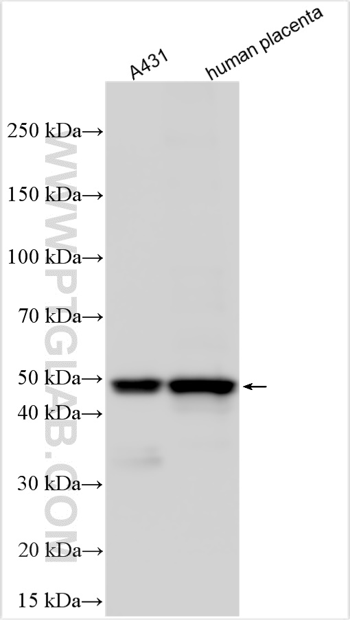 WB analysis using 31006-1-AP