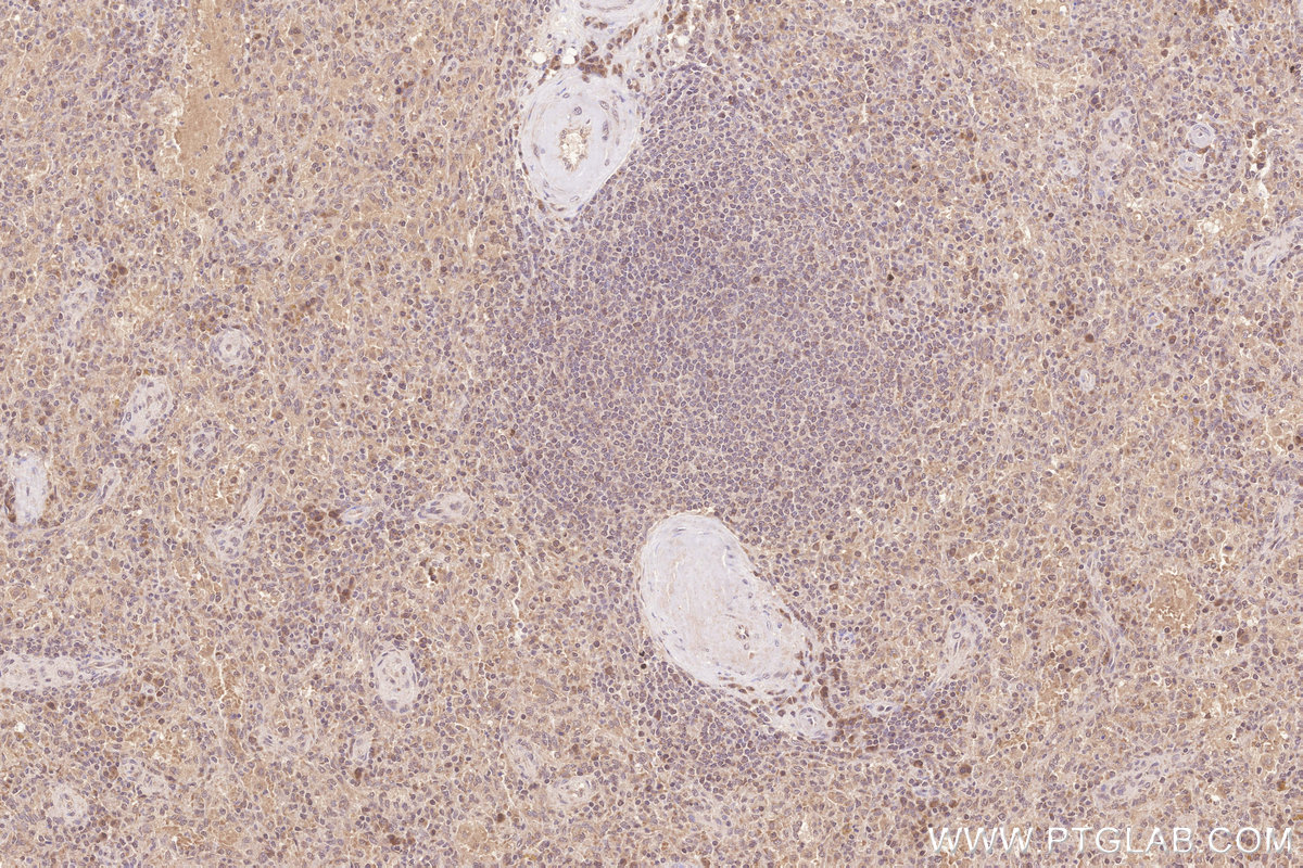 IHC staining of human spleen using 25038-1-AP