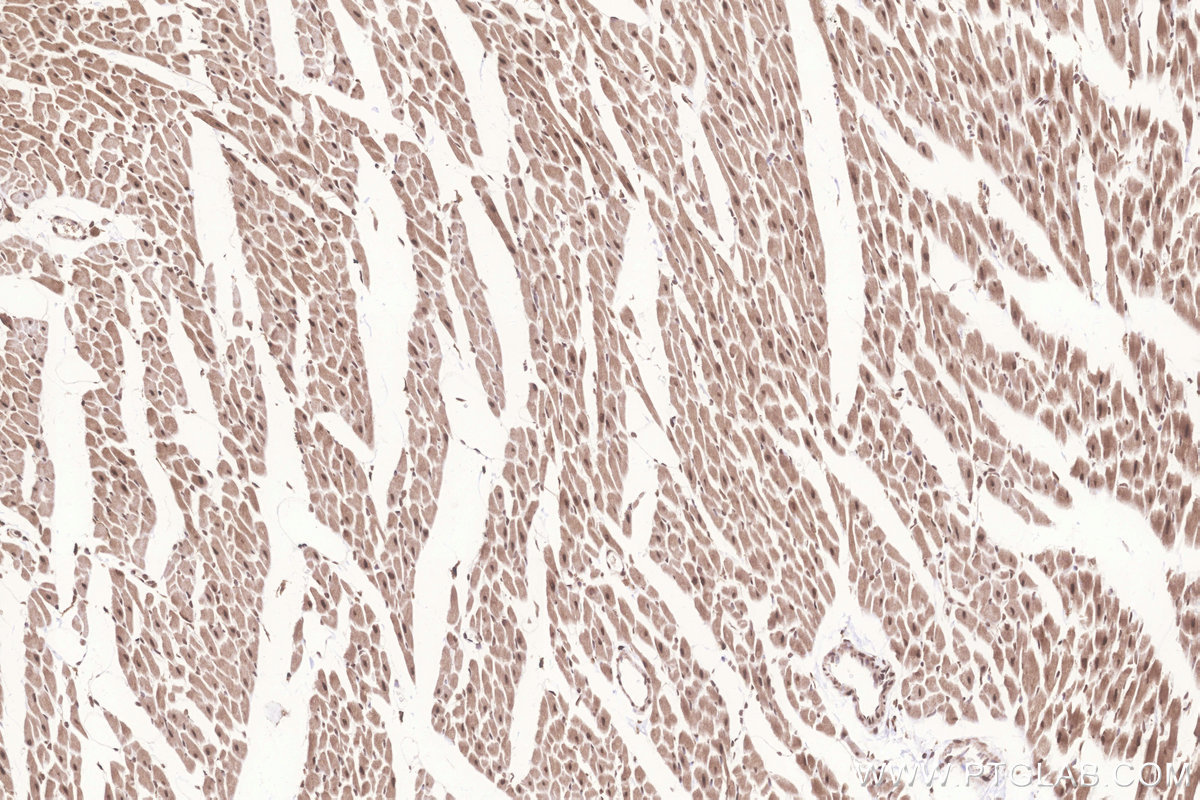 IHC staining of rat heart using 25038-1-AP