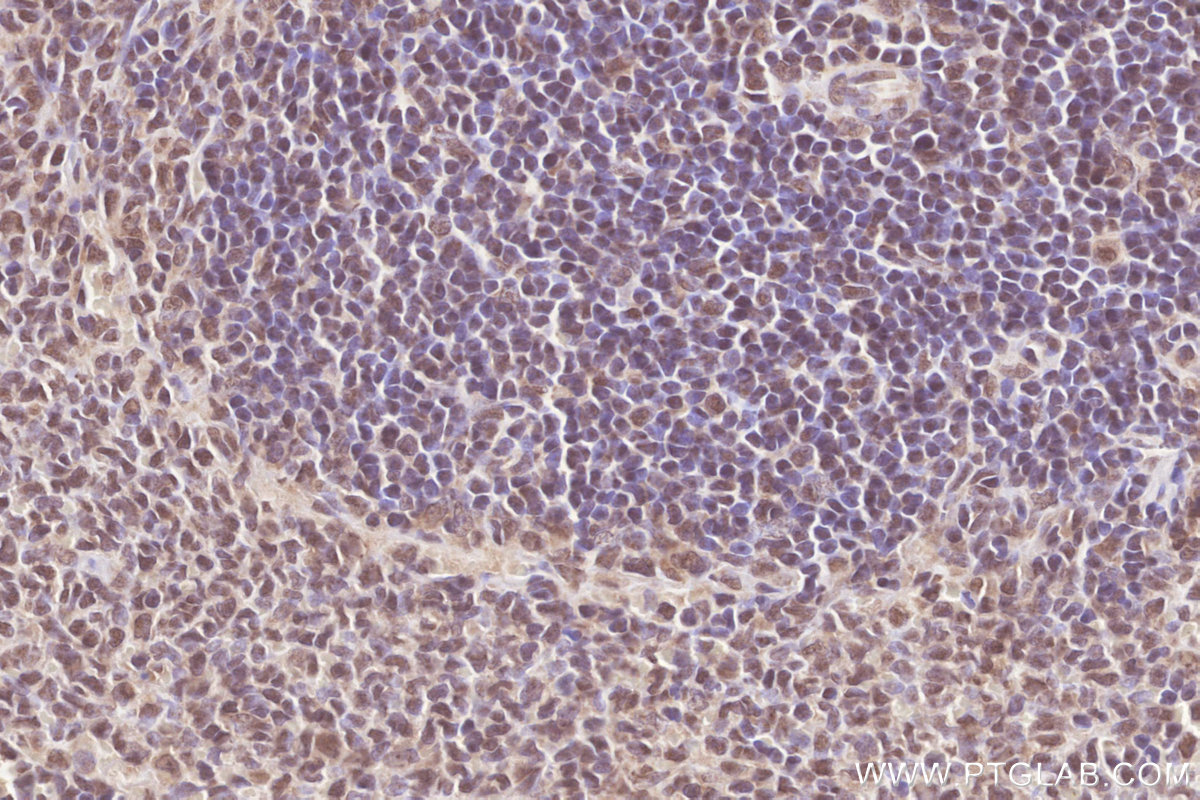 IHC staining of rat spleen using 25038-1-AP