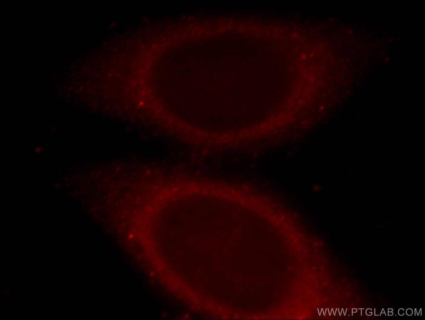 IF Staining of HepG2 using 20127-1-AP