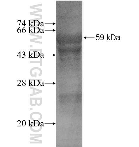 FAM55A fusion protein Ag15021 SDS-PAGE FAM55A fusion protein Ag15021 SDS-PAGE