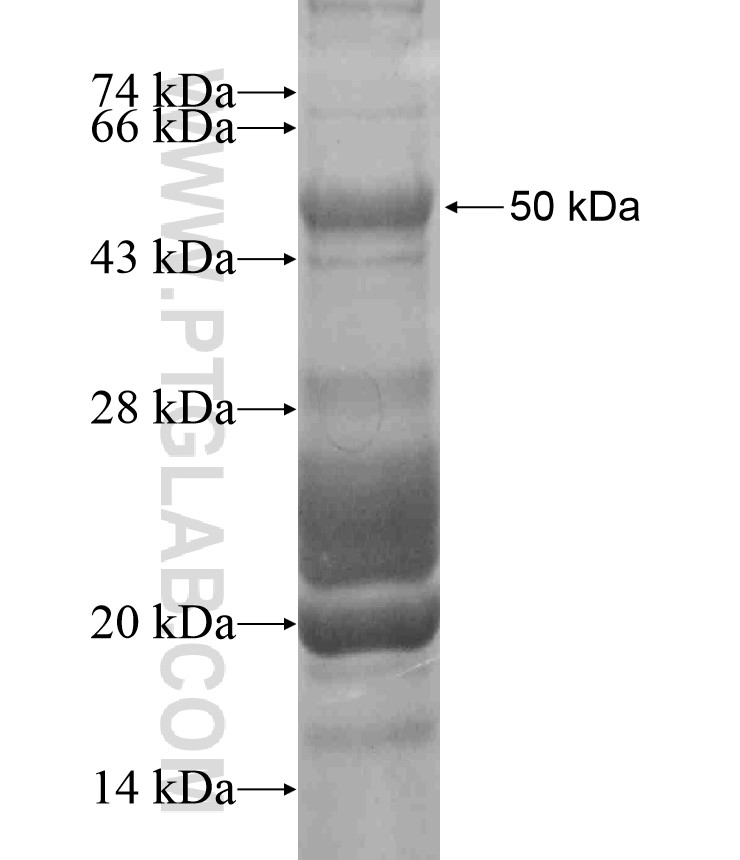 FAM5C fusion protein Ag18455 SDS-PAGE FAM5C fusion protein Ag18455 SDS-PAGE