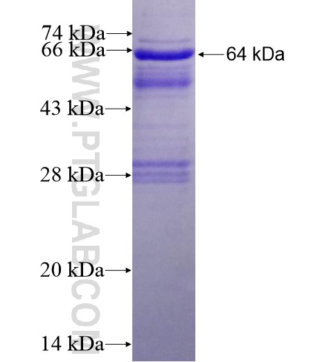 FAM62A fusion protein Ag13895 SDS-PAGE