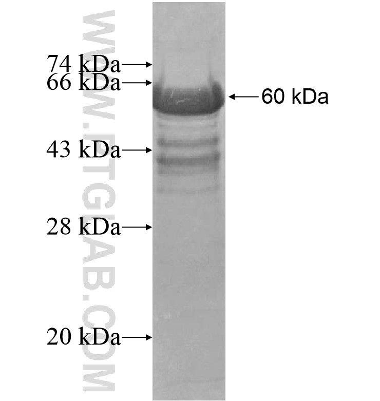 FAM63A fusion protein Ag16177 SDS-PAGE FAM63A fusion protein Ag16177 SDS-PAGE