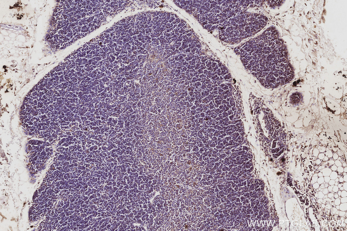 IHC staining of mouse thymus using 17015-1-AP IHC staining of mouse thymus using 17015-1-AP