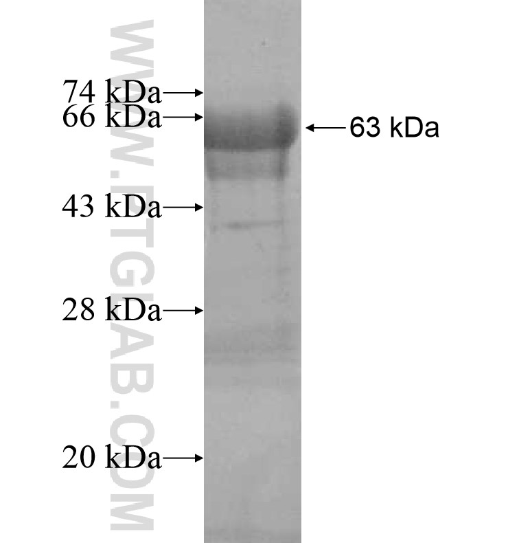 FAM65B fusion protein Ag16889 SDS-PAGE FAM65B fusion protein Ag16889 SDS-PAGE