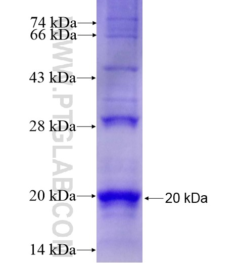 FAM71F1 fusion protein Ag15981 SDS-PAGE FAM71F1 fusion protein Ag15981 SDS-PAGE