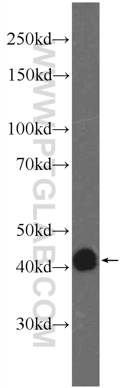 WB analysis of PC-3 using 24286-1-AP