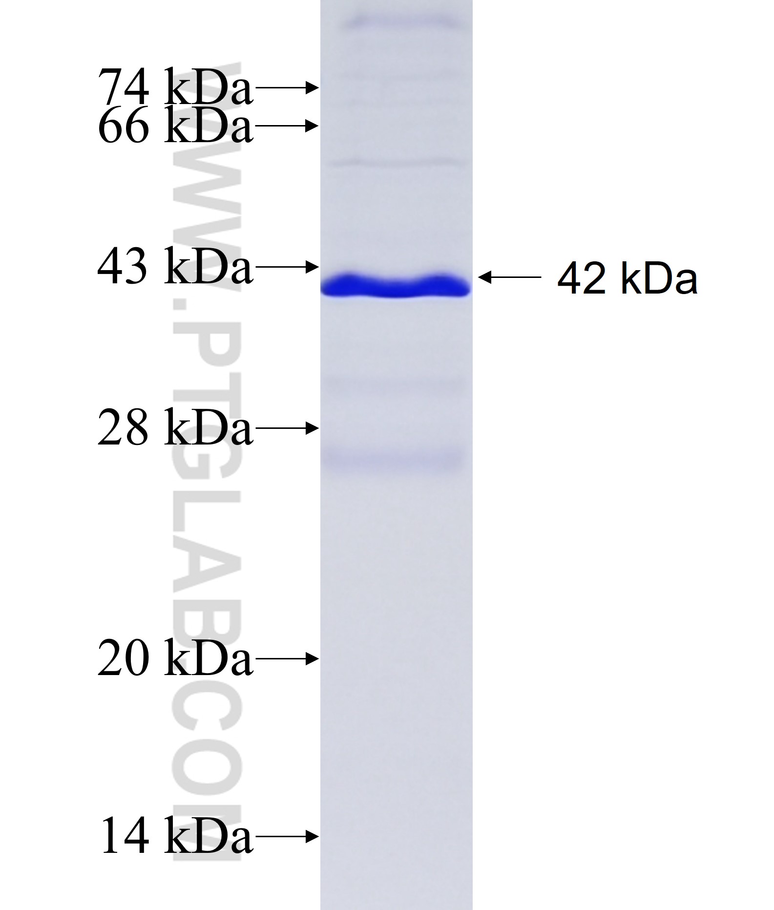 FAM72A fusion protein Ag15566 SDS-PAGE