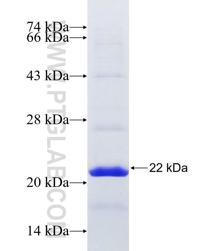 FAM72A fusion protein Ag16627 SDS-PAGE FAM72A fusion protein Ag16627 SDS-PAGE