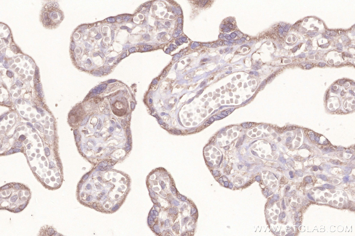 IHC staining of human placenta using 29811-1-AP IHC staining of human placenta using 29811-1-AP