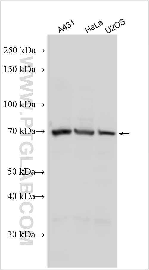 WB analysis using 29811-1-AP