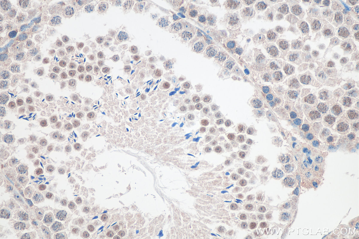 IHC staining of mouse testis using 20863-1-AP