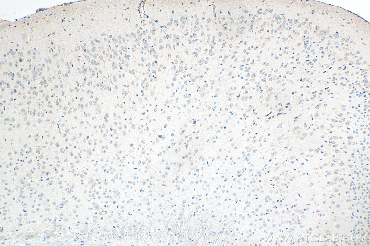 IHC staining of mouse brain using 32882-1-AP IHC staining of mouse brain using 32882-1-AP
