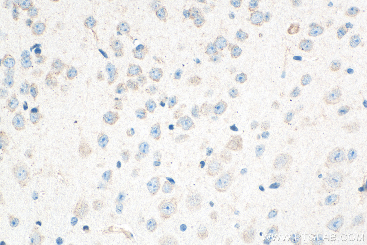 IHC staining of mouse brain using 32882-1-AP IHC staining of mouse brain using 32882-1-AP