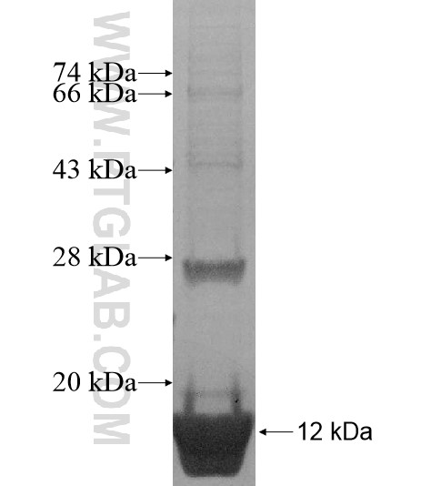 FAM78A fusion protein Ag15643 SDS-PAGE FAM78A fusion protein Ag15643 SDS-PAGE