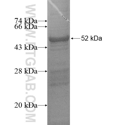 FAM81B fusion protein Ag15035 SDS-PAGE FAM81B fusion protein Ag15035 SDS-PAGE