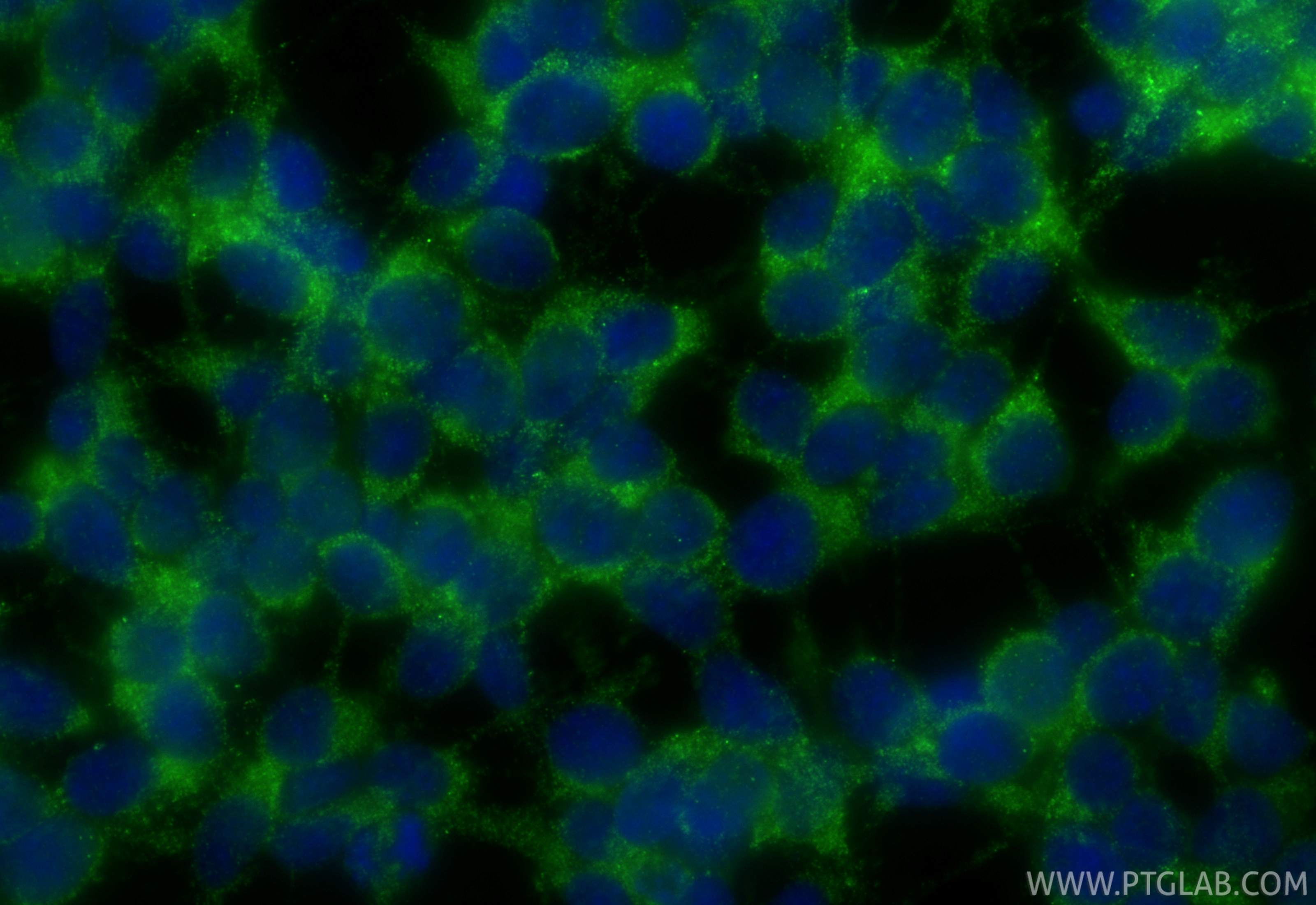 IF Staining of SH-SY5Y using 33752-1-AP