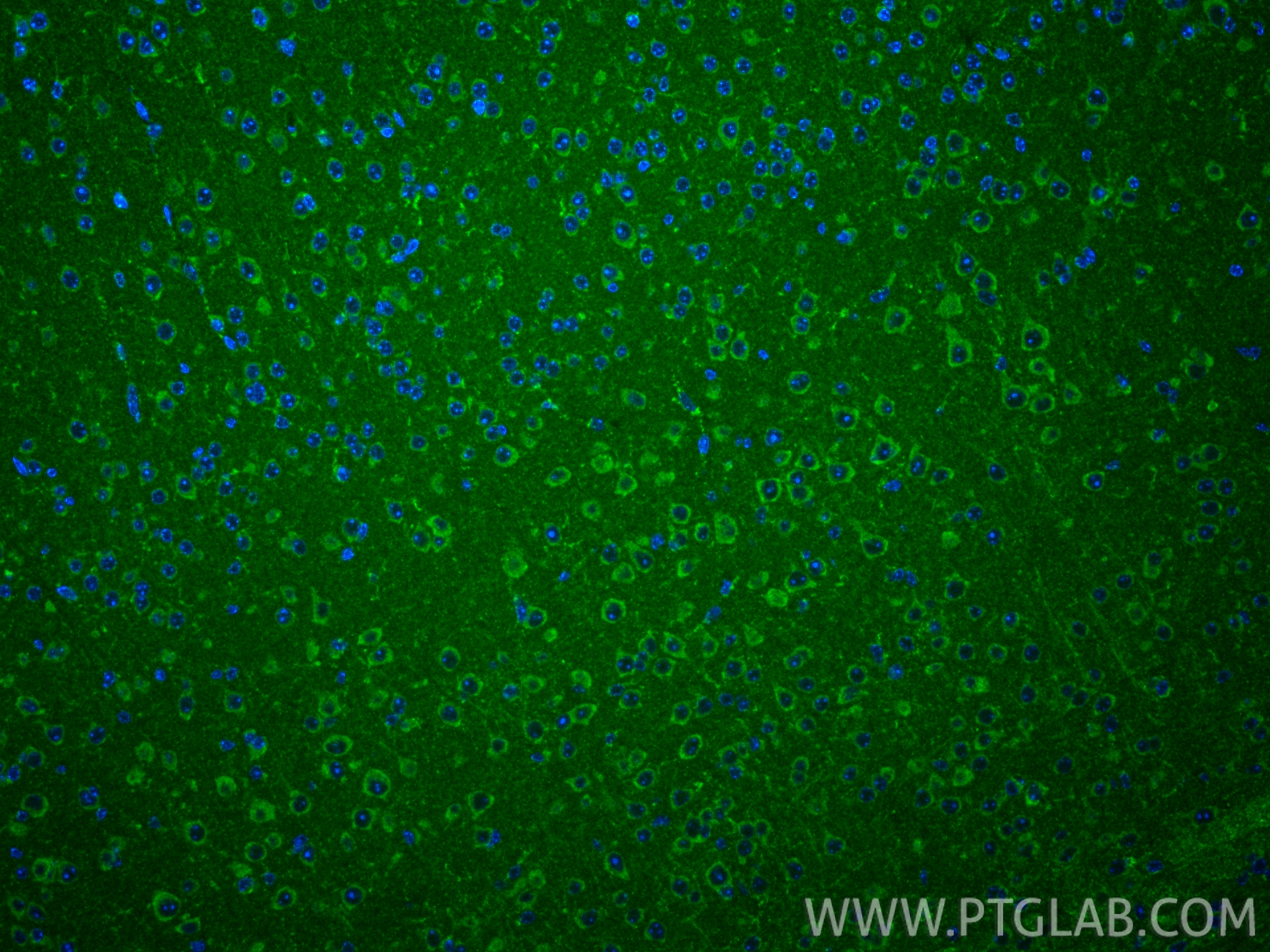 IF Staining of mouse brain using 24919-1-AP IF Staining of mouse brain using 24919-1-AP