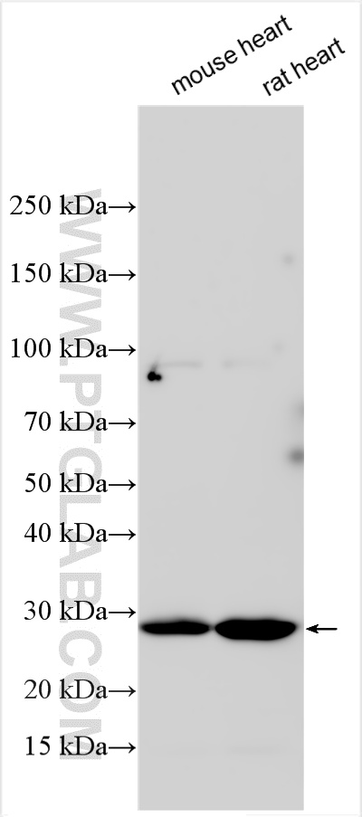Various lysates were subjected to SDS PAGE followed by western blot with 24919-1-AP (FAM82B antibody) at dilution of 1:1000 incubated at room temperature for 1.5 hours. WB analysis using 24919-1-AP