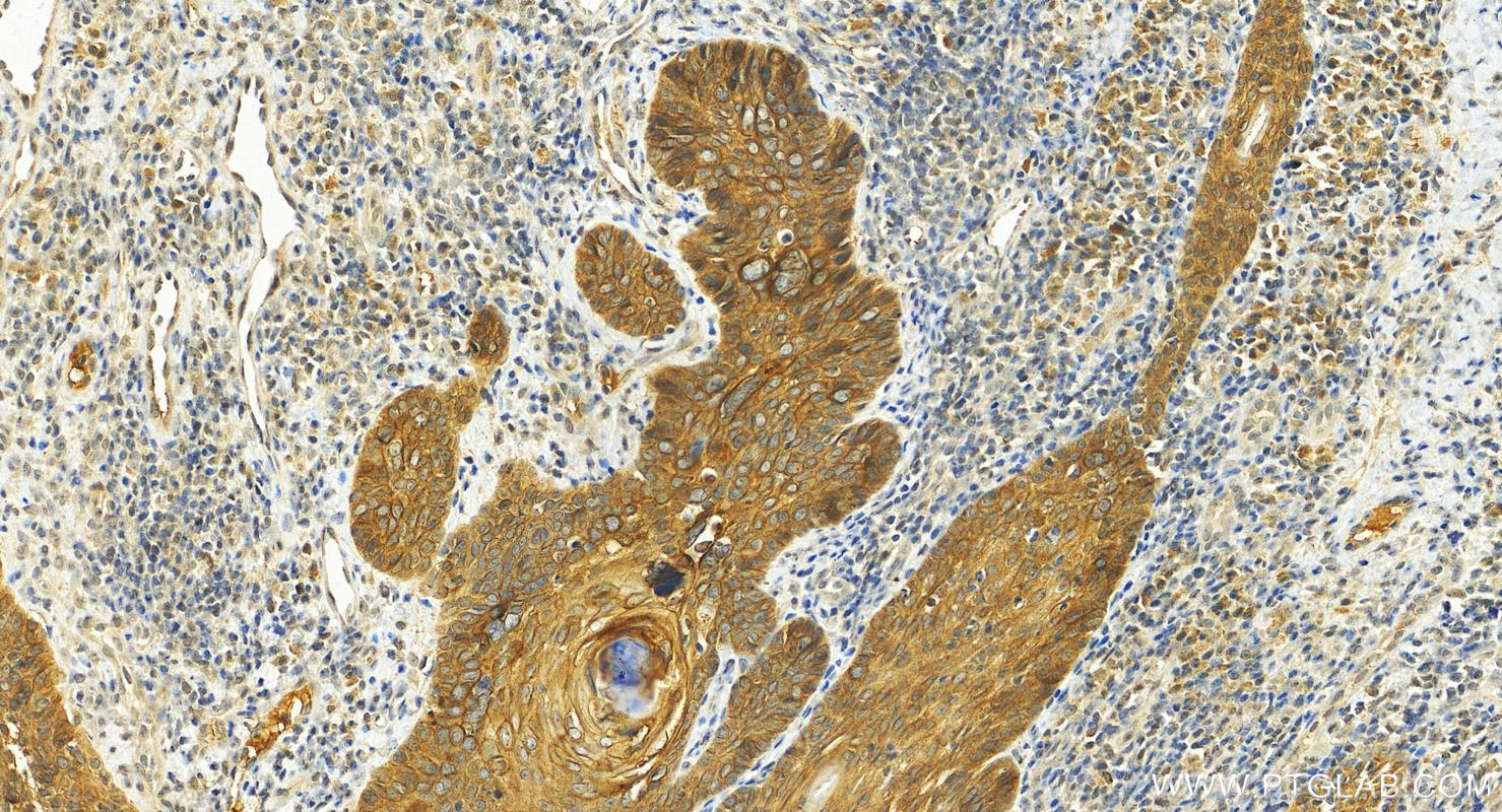 IHC staining of human brown disease using 26032-1-AP