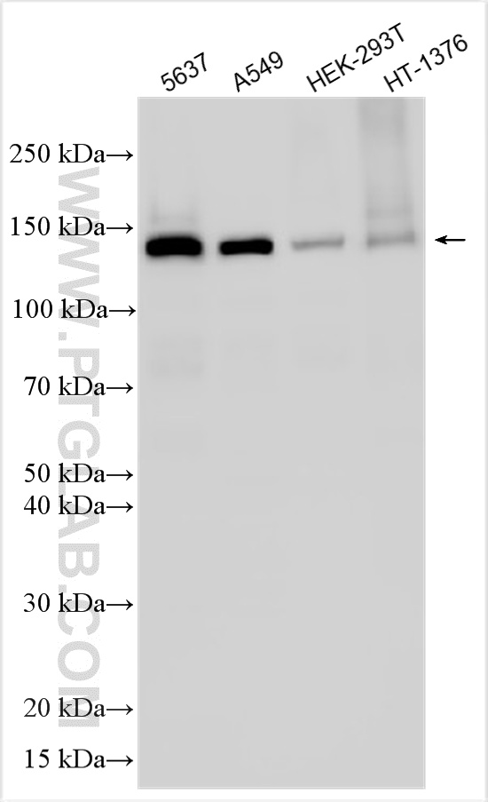 WB analysis using 31974-1-AP (same clone as 31974-1-PBS) WB analysis using 31974-1-AP (same clone as 31974-1-PBS)