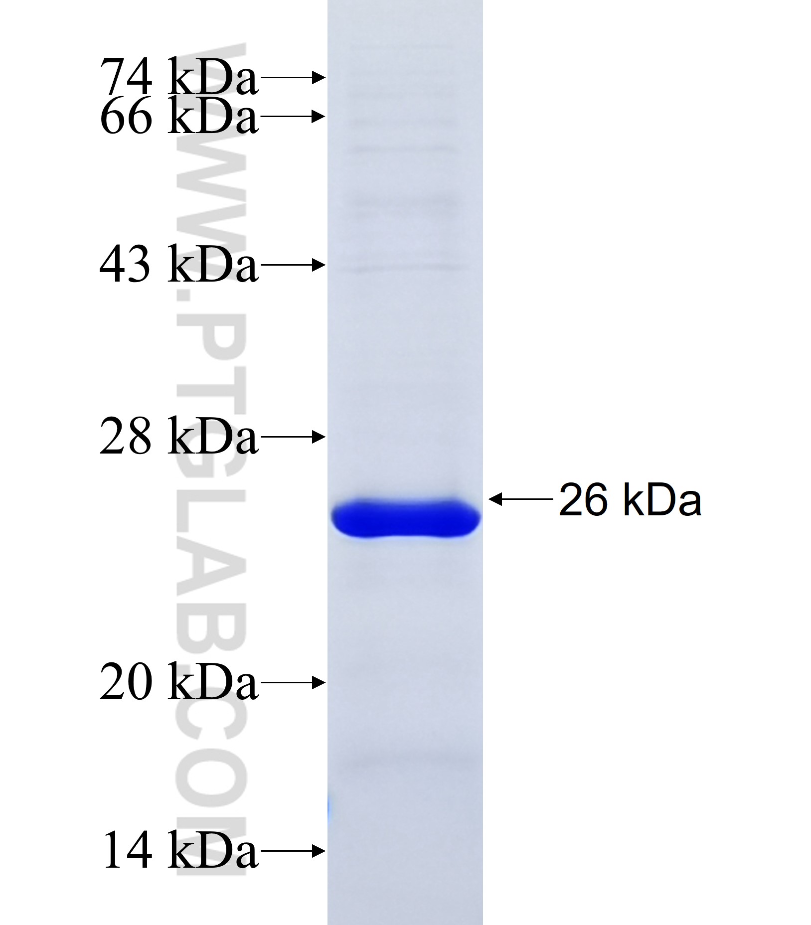 FAM83H fusion protein Ag37162 SDS-PAGE FAM83H fusion protein Ag37162 SDS-PAGE