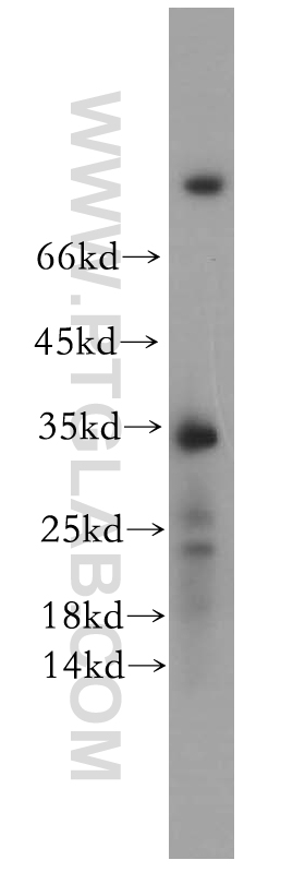 FAM84B Polyclonal antibody