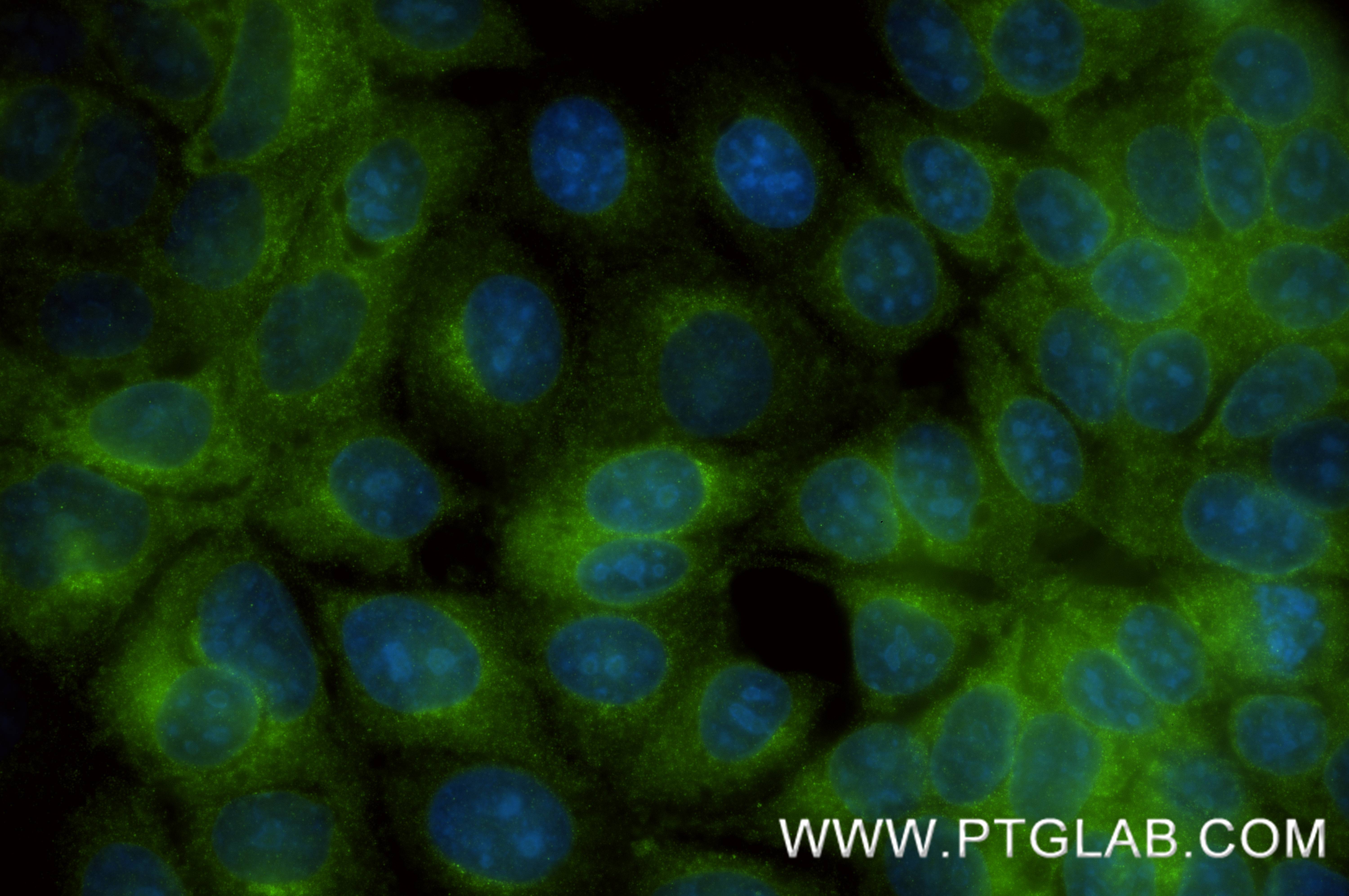 IF Staining of MCF-7 using 87176-3-RR (same clone as 87176-3-PBS) IF Staining of MCF-7 using 87176-3-RR (same clone as 87176-3-PBS)