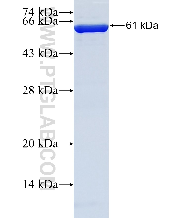 FAM86A fusion protein Ag38481 SDS-PAGE
