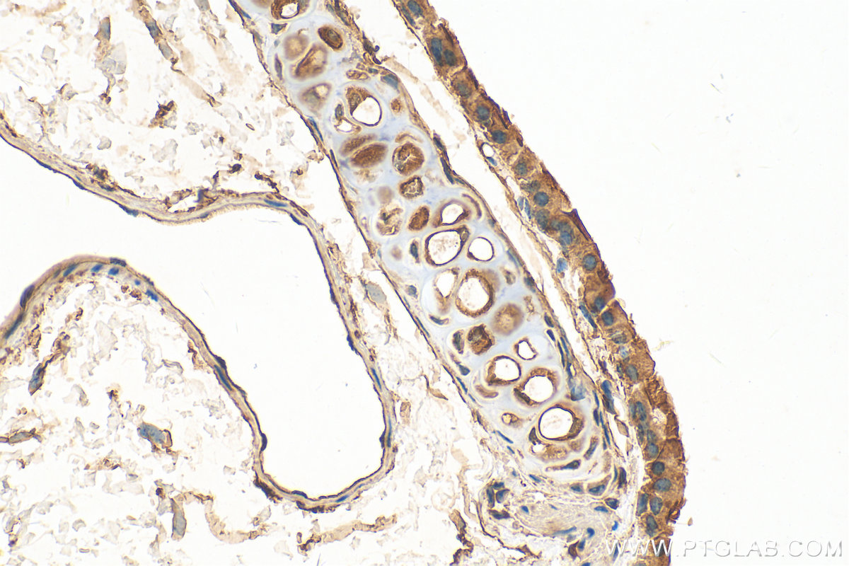 IHC staining of mouse lung using 26413-1-AP