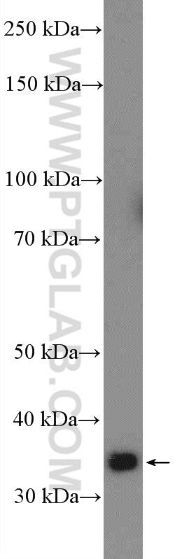 WB analysis of HeLa using 26413-1-AP