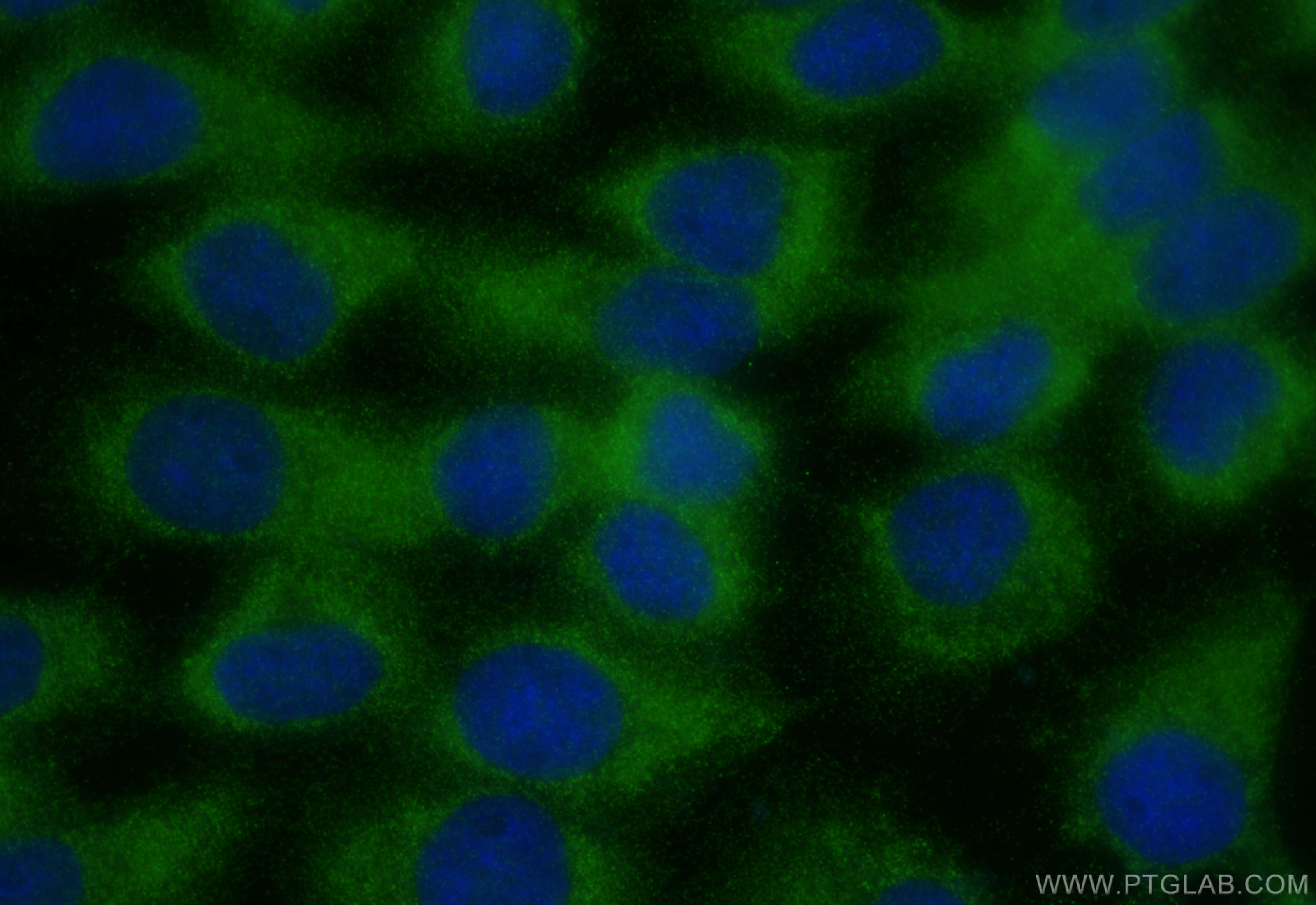 IF Staining of A431 using 20776-1-AP